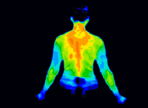 Akta Liv- Exames- Termografia Cervical