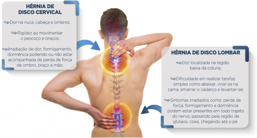 Akta Liv - endocrinologia - nutrição - fisioterapia - dor nas costas - hernia de disco