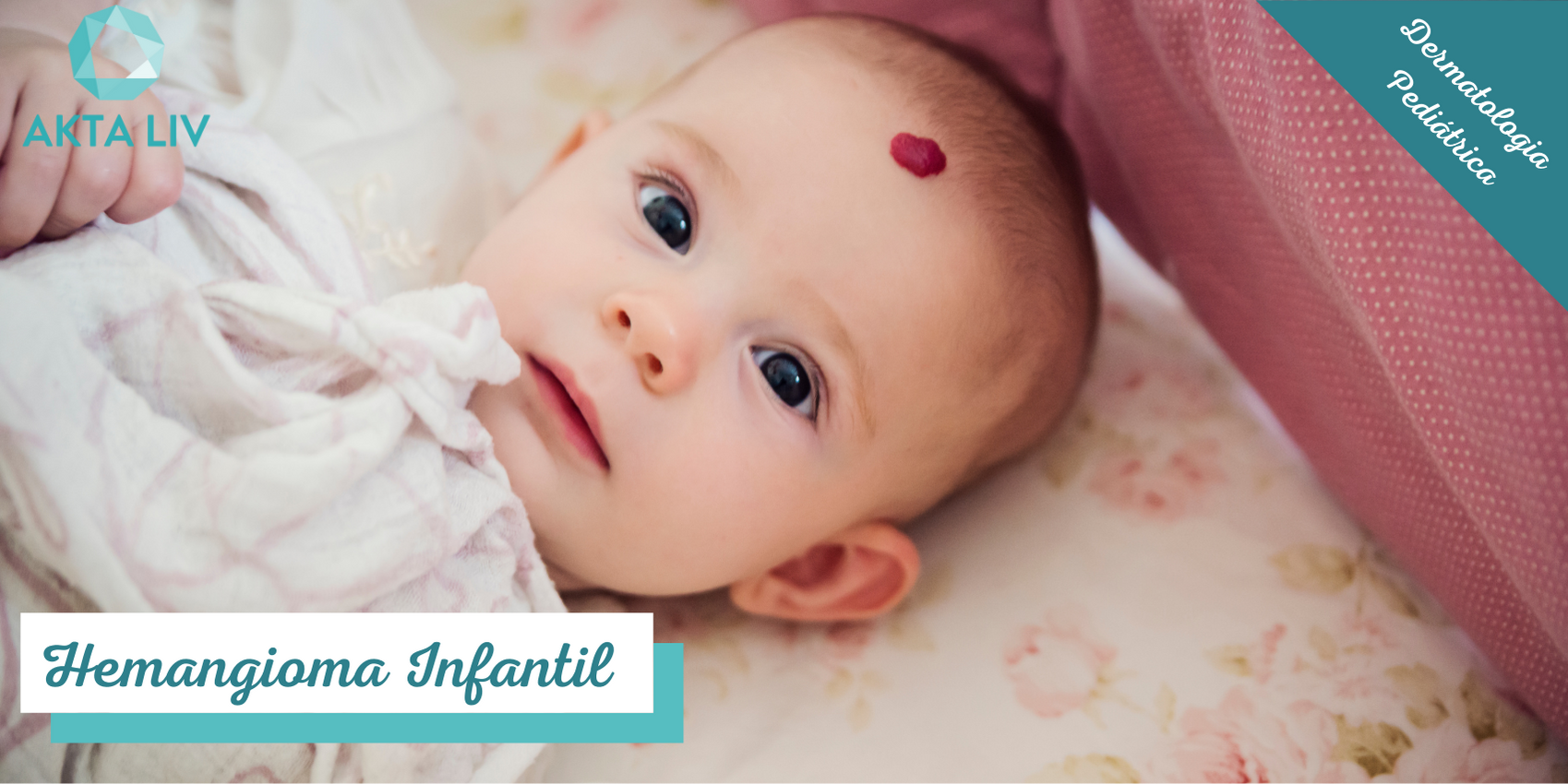 AKTA-Liv-Dermatologia-Hemangioma-Infantil