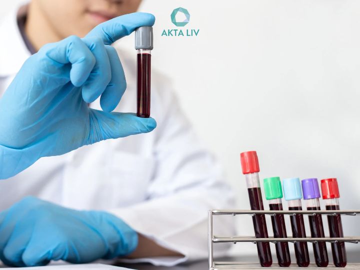 AKTA-Liv-Clinica-de-Emagrecimento-exames-para-emagrecer-exame-de-sangue